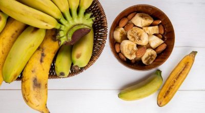 Entenda cada tipo de banana/Freepik / Entenda cada tipo de banana/Freepik